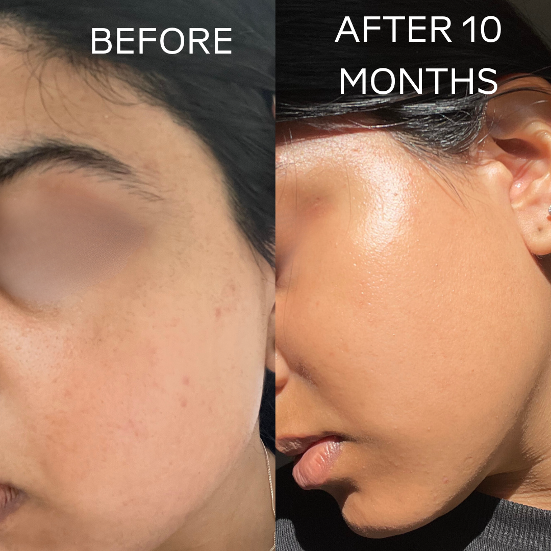 Unfiltered Glow Face/Body Mask