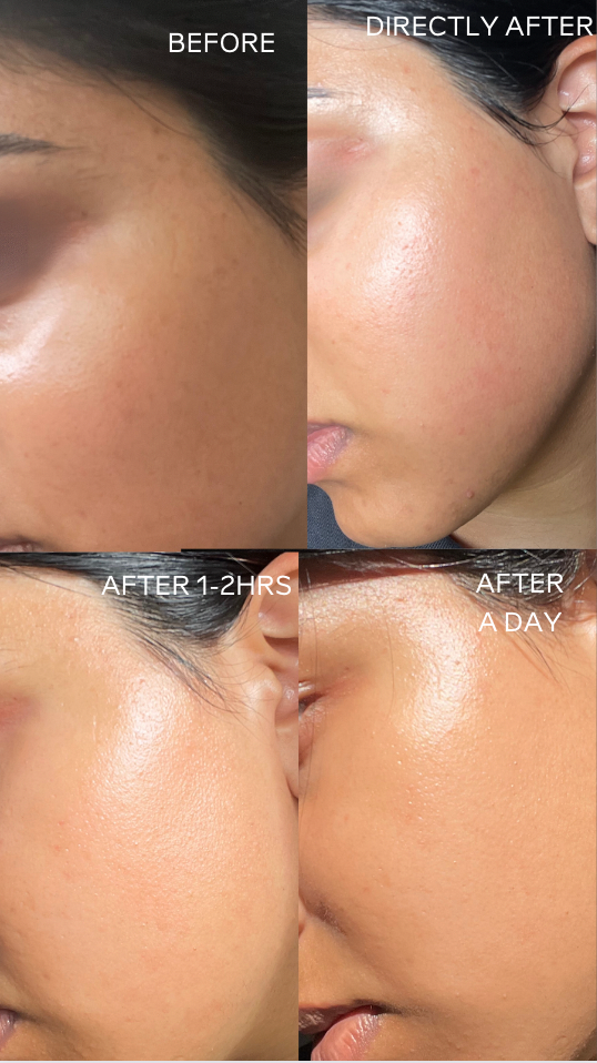Unfiltered Glow Face/Body Mask